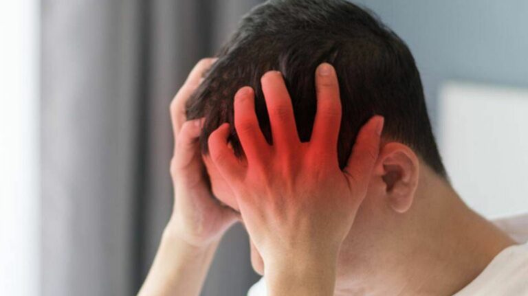 Quelle est la meilleure façon de prendre du CBD pour soulager les maux de tête